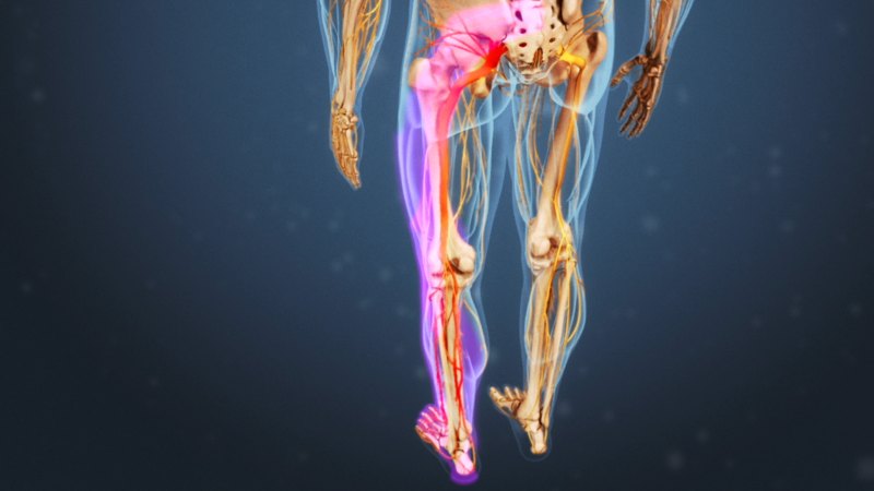 چگونه ماساژ میتواند به درمان سیاتیک پای چپ کمک کند؟