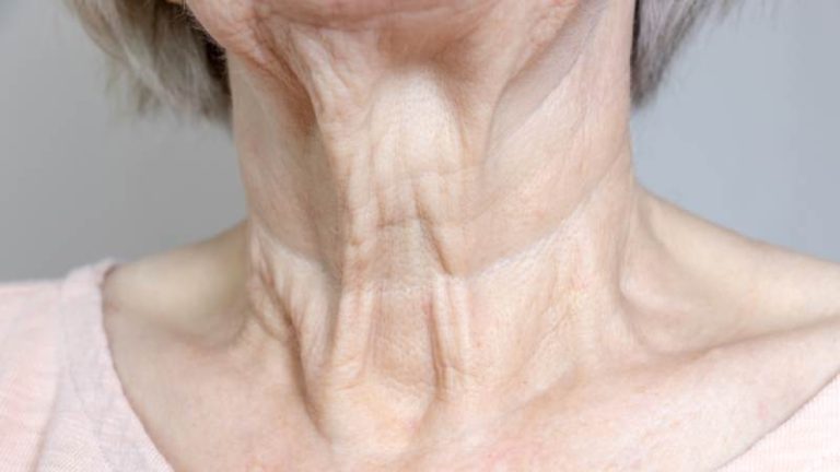 ماساژ گردن برای رفع چروک در خانه