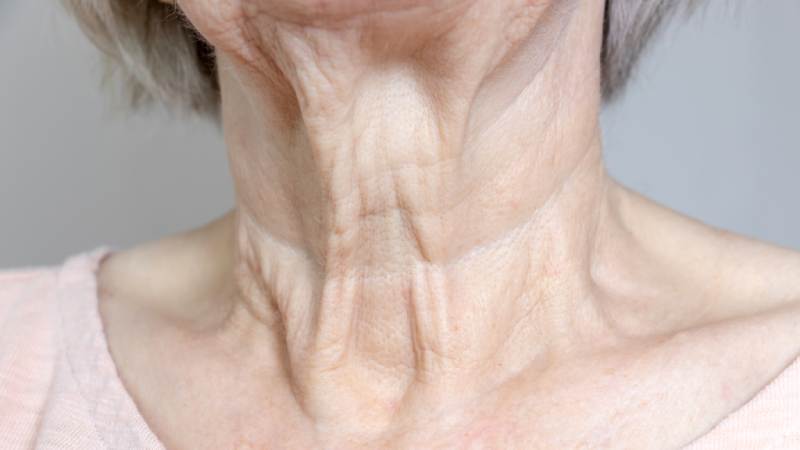 ماساژ گردن برای رفع چروک در خانه