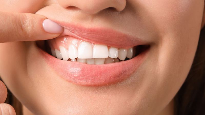 آموزش ماساژ لثه تحلیل رفته در خانه