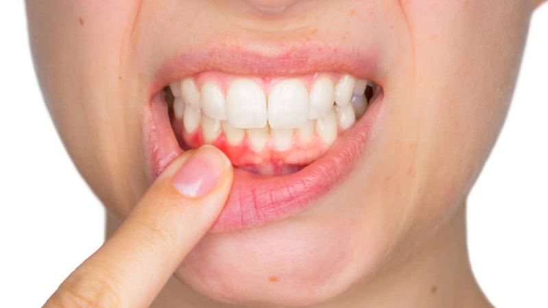 مدت زمان ماساژ لثه