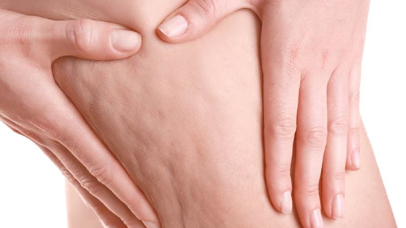 برای کاهش سلولیت چند بار باید ماساژ دهید؟